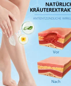 Ceoerty™ Krampfadern-Creme mit Hydrogel