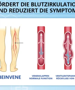 Ceoerty™ Krampfadern-Creme mit Hydrogel