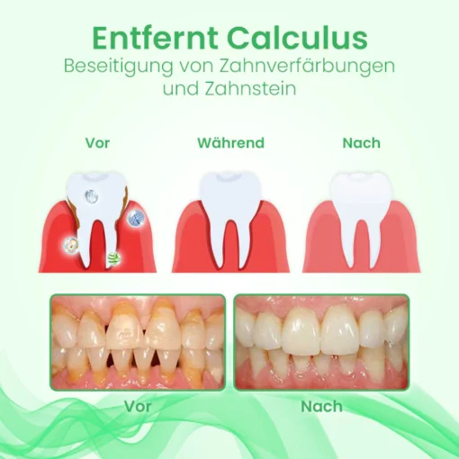 Ceoerty™ OralCure Ampulle Zahnserum