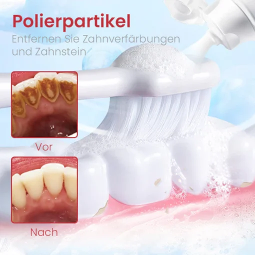 Ceoerty™ PRODent Probiotische Whitening-Zahnpasta