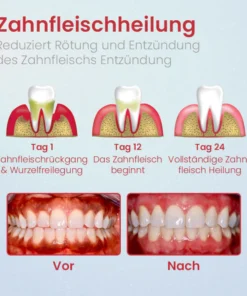 Ceoerty™ PRODent Probiotische Whitening-Zahnpasta