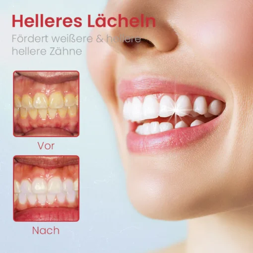 Ceoerty™ PRODent Probiotische Whitening-Zahnpasta