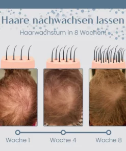 Ceoerty™ Root Renew Pflegendes Haarpeeling