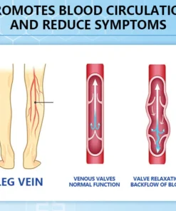 Ceoerty™ Varicose Veins Cream with Hydrogel