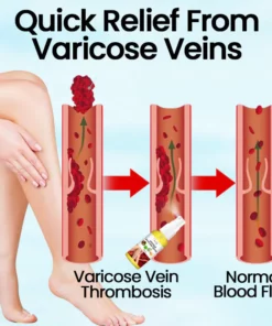 Ceoerty™ VeinMist Varicose Vein Spray