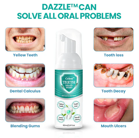 DAZZLE™ TEETH Mouthwash - Solve all Oral Problems