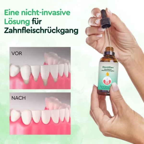 DentiZen™ Zahnfleisch-Wachstumstropfen - Image 3