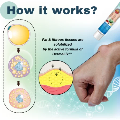 DermaFix™ Lipoma Removal Cream - Image 5