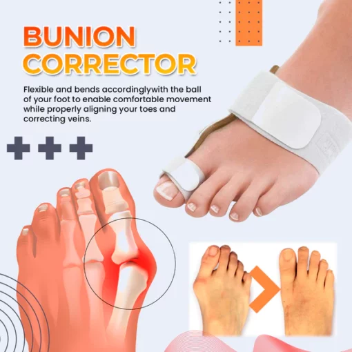 Drto™ Bunion Splint Correclor - Image 2