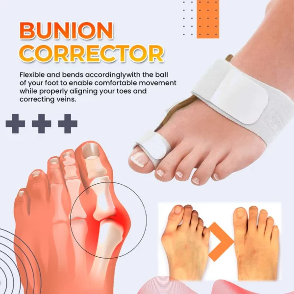 Drto™️ Bunion Splint Corrector - Image 2