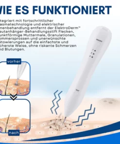 ElektroDerm™ Hautanhänger-Behandlungsstift