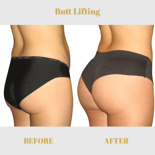 Fivfivgo™ Collagen Buttock Enlargement Patch - Image 5