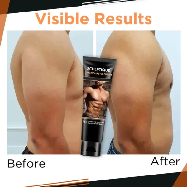 GFOUK™ Gynecomastia Cream - Image 4