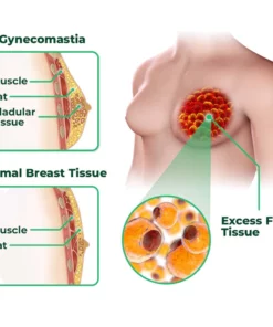 GFOUK™ GynoReduct Gynecomastia Diminishing Patch