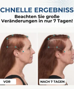 HairGenix™ Haarwuchs Kapseln