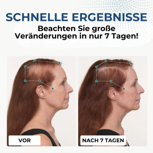 HairGenix™ Haarwuchs Kapseln