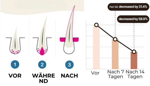 HairGenix™ Haarwuchs Kapseln
