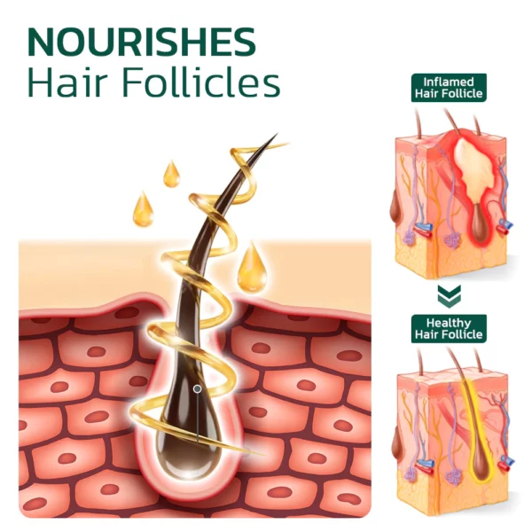 HairVive™ Scalp Folliculitis Therapy Oil - Image 2