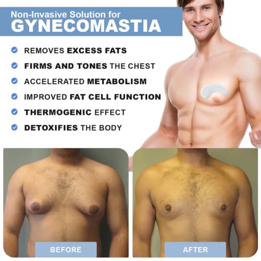 Luhaka™ GynoPatch - Advanced Gynecomastia Reduction Patch - Image 4