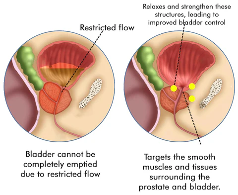 ODEIUN™ Prostate Treatment Drops - Safest & Fastest Waytorelief Prostate