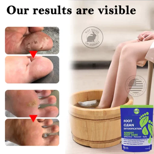 Oveallgo™ Herbal Detox Cleansing Foot Care Pack - Image 3