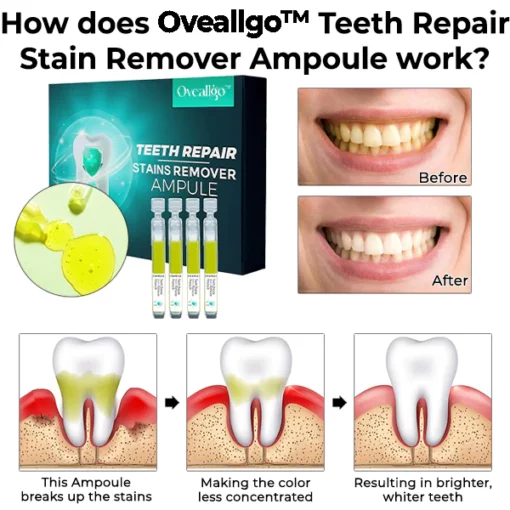 Oveallgo™ PRO Teeth Repair Stain Remover Ampoule - Image 2