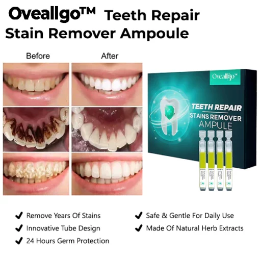 Oveallgo™ PRO Teeth Repair Stain Remover Ampoule - Image 4