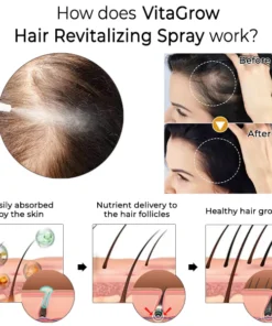 Oveallgo™ VitaGrow Hair Revitalizing Spray