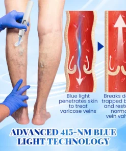 PosrystTM Blue Light Therapy Set for Varicose Veins