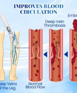 PosrystTM Blue Light Therapy Set for Varicose Veins