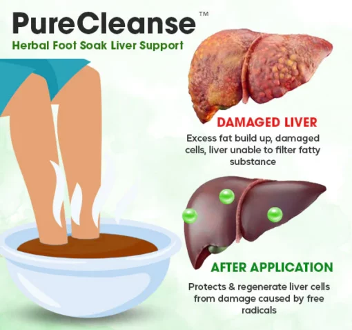 PureCleanse™ Herbal Foot Soak Liver Support - Image 5