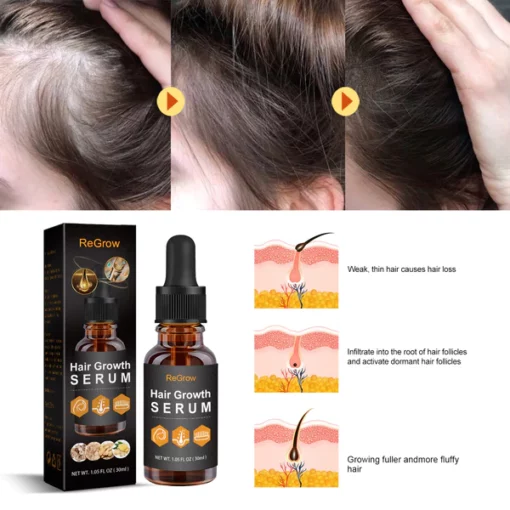 ReGrow™ VitaStrands Hair Growth Serum