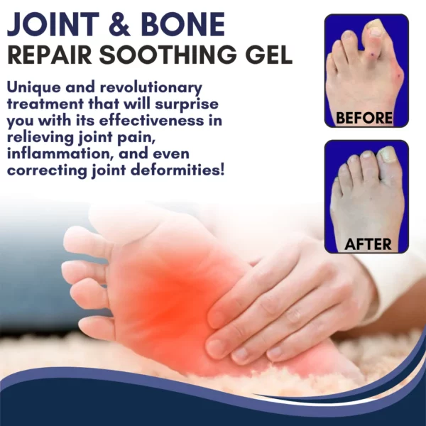 Restora™ Joint & Bone Repair Gel Roller - Image 3