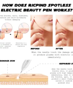 Ricpind Spotless HomeProfessional Electric BeautyPen