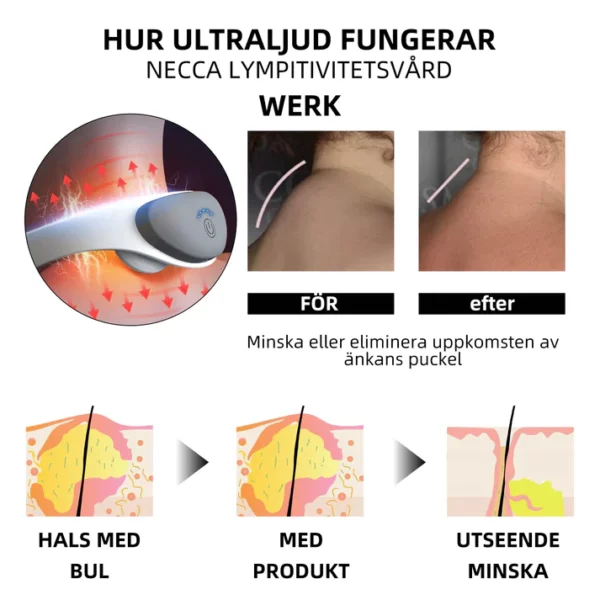 Ricpind Ultraljud Lymfvårds Nacken Enhet - Image 2