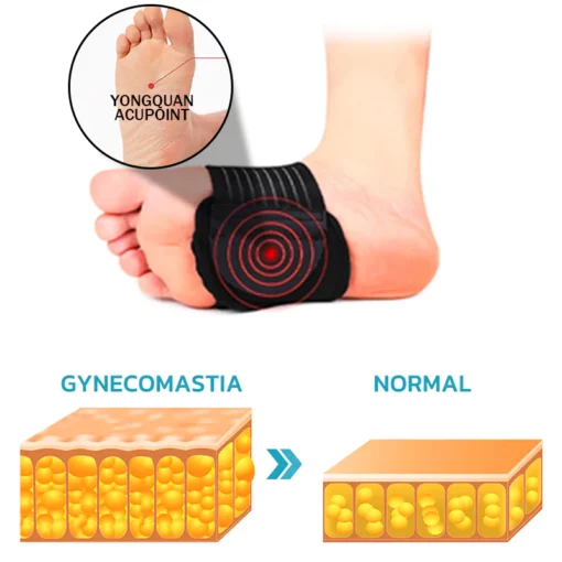 Salis™ Acupoint Magnetic Therapy Forefoot Pad for Weight Loss