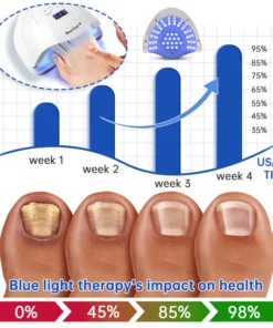 Seurico™ PureNail Fungus Laser Therapy Device