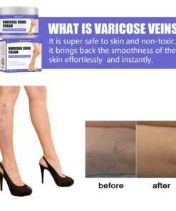 Seurico™ Varicose Veins Cream