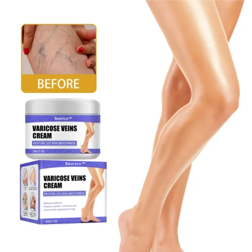 Seurico™ Varicose Veins Cream