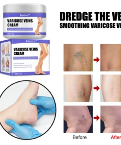 Seurico™ Varicose Veins Cream