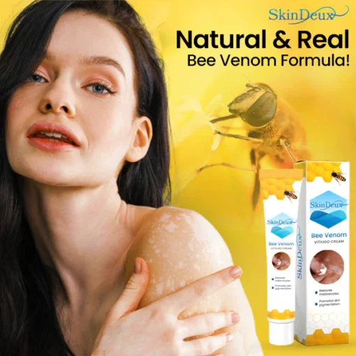 SkinDeux™ Bee Venom Vitiligo Cream