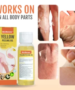 SkinRenew™ Yellow Peeling Oil