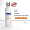 Skinenjoy® Cleansing Lotion for Acne & Spots & Acanthosis Nigricans Congratulations