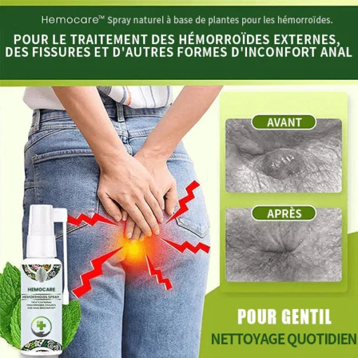 Spray d'herbes Hemocare™ pour les hémorroïdes- French