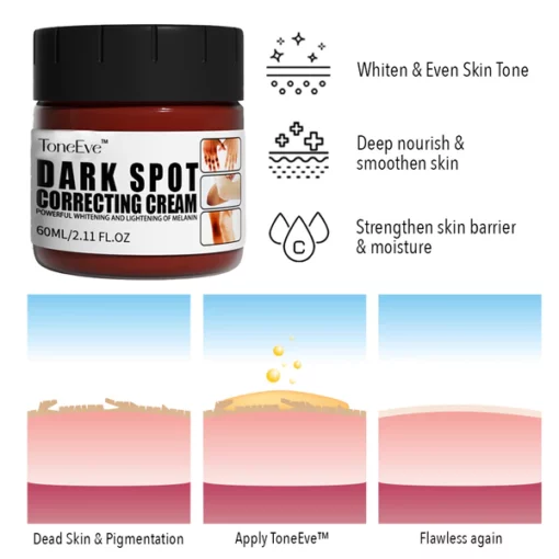 ToneEve™ Dark Spot Correcting Cream