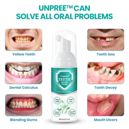 UNPREE™ Daily TEETH Mouthwash Foam - Solve All Oral Problems