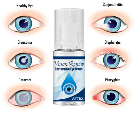 Vision RenewRestorative Eye Drops