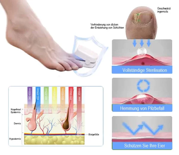 AEXZR™ Revolutionary High Efficiency Light Therapy Device for Toenail Disease