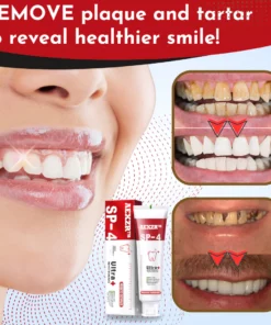 AEXZR™ SP-4 Whitening Probiotic Toothpaste