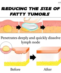 ATTDX LymphNode SculptingDrainage DetoxCream